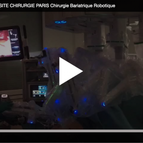 Dr. Bruto Randone, Chirurgien Digestif et Bariatrique | OBESITE CHIRURGIE PARIS | CHIRURGIE DIGESTIVE PARIS 